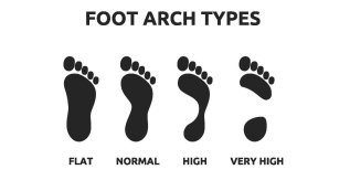 Feet Arch Types